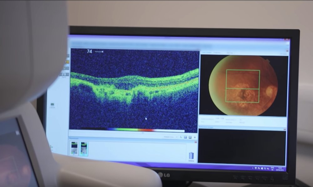 La Inteligencia Artificial de DeepMind ya sugiere tratamiento para más de 50 dolencias oculares