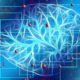 IBM y Pfizer desarrollan un modelo de IA para predecir el Alzheimer antes de que se manifieste